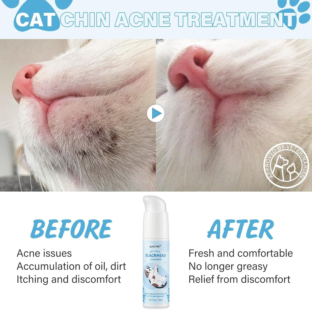 Cat Chin Acne Care Kit - Gently Removes Cat Chin Blackheads, Equipped with Cleansing Brush, Cruelty-Free, Nurtures Cat'S Chin Softness and Freshness, 1.01 Fl. Oz